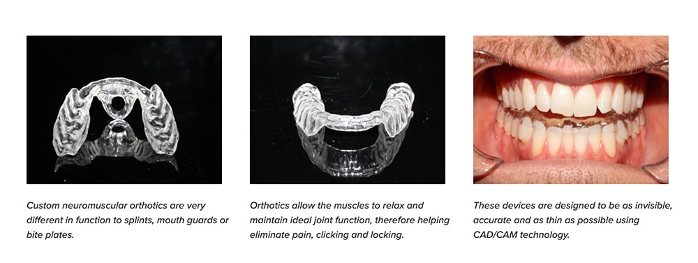 neuromuscular orthotics